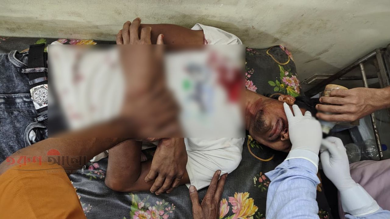 মোল্লাহাটের দারিয়ালা গ্রামে পলাশ নামের যুবককে কুপিয়ে জখম।